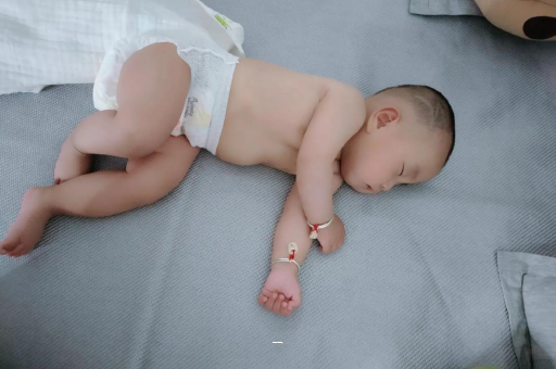 东至宝宝脸上有白色斑块